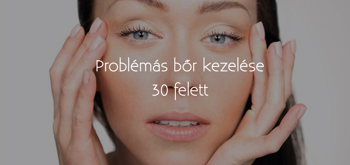Problémás bőr kezelése 30 felett